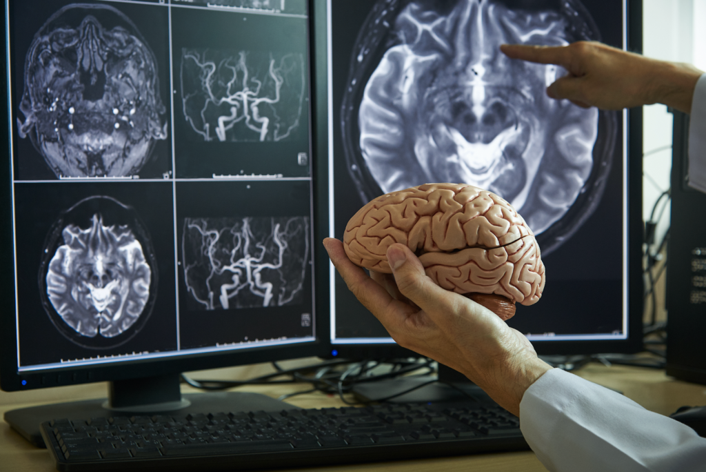 médico demonstrando anatomia do cérebro humano e o resultado de uma ressonância magnética em segundo plano 